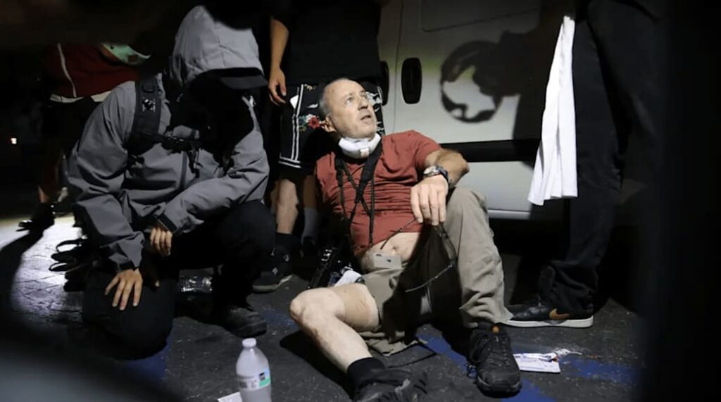 LA Protests: British Photographer Struck by Non-Lethal Bullet